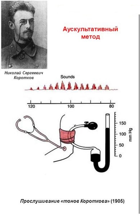 Методы ад. Метод Короткова для измерения артериального давления. Измерение давления методом Короткова. Измерение ад методом Короткова. Измерение артериального давления по методу Короткова алгоритм.