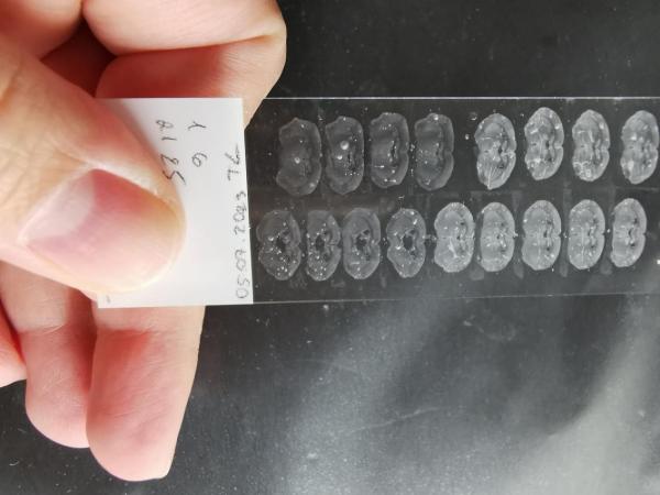 Ученые из России сделали шаг к созданию первого лекарства от аутизма