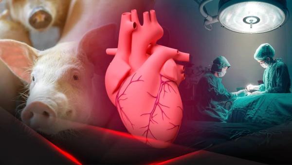 Как учёные преодолевают иммунные барьеры при пересадке органов от животных человеку Как учёные преодолевают иммунные барьеры при пересадке органов от животных человеку