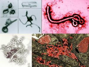 Фото в левом верхнем углу оригинал 1976 г., оцените развитие микроскопии за 50 лет
