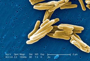 Туберкулез вызывает патогенная микобактерия Mycobacterium tuberculosis, которую люди знают под названием &quot;палочка Коха&quot;