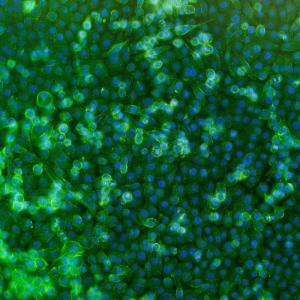 Культура опухолевых клеток, снятых на флуоресцентный микроскоп
