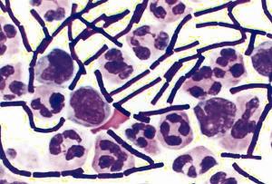Бактерии сибирской язвы под электронным микроскопом