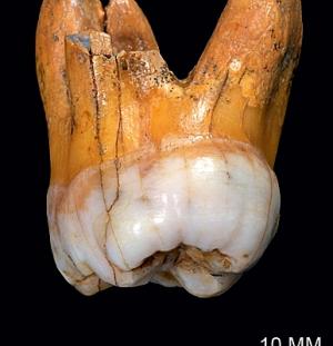 Зуб «денисовского» человека наряду с фрагментом фаланги мизинца стал для генетиков ключом к геному неведомого ранее вида людей