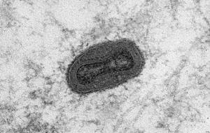 Зрелая частица вируса осповакцины