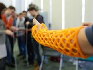 Руки-ноги из принтера: технология 3D-печати приходит в российскую медицину