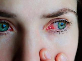 В ИЦиГ СО РАН разработан гипоаллергенный препарат для лечения вирусных заболеваний глаз