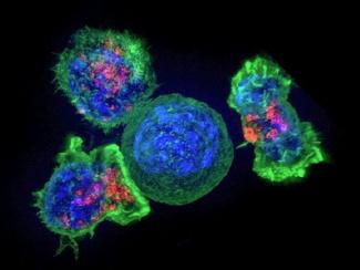 Нобелевскую премию по физиологии и медицине присудили за терапию рака путем блокировки «тормозов» в иммунных клетках